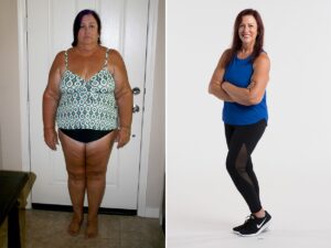 Buy Ozempic Online for weight loss & Diabetes 4 weight loss transformation image with Ozempic